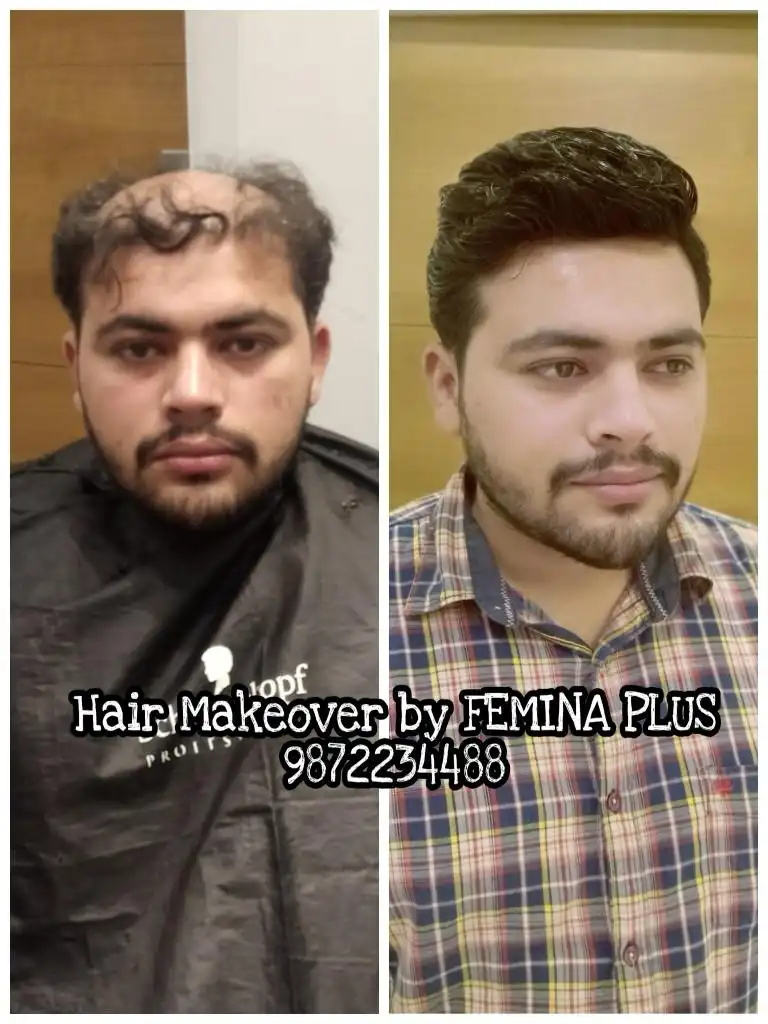https://assets.feminaplussalon.com/public/solutions/hair_patch_services_new.webp